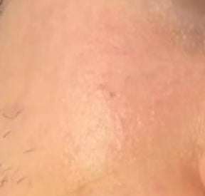 PEELING FACIAL I'VEL
